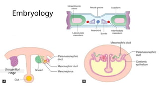 Rogenital Ridge FM urogenital system embroyology, ultrasound features and management.pptx