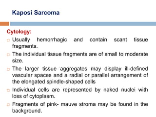 Kaposi Sarcoma
Cytology:
 Usually hemorrhagic and contain scant tissue
fragments.
 The individual tissue fragments are of small to moderate
size.
 The larger tissue aggregates may display ill-defined
vascular spaces and a radial or parallel arrangement of
the elongated spindle-shaped cells
 Individual cells are represented by naked nuclei with
loss of cytoplasm.
 Fragments of pink- mauve stroma may be found in the
background.
 
