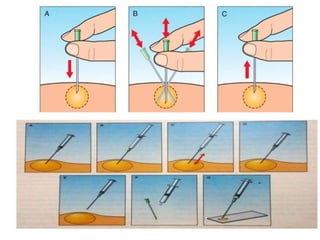 Fine needle aspiration cytology | PPTX