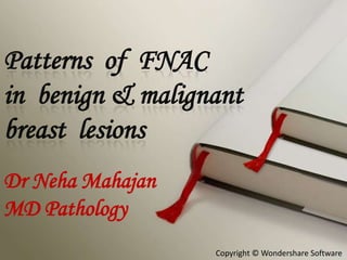 Patterns of FNAC
in benign & malignant
breast lesions
Dr Neha Mahajan
MD Pathology
Copyright © Wondershare Software

 