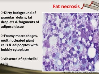 Fat necrosis
Dirty background of
granular debris, fat
droplets & fragments of
adipose tissue
Foamy macrophages,
multinucleated giant
cells & adipocytes with
bubbly cytoplasm

Absence of epithelial
cells
Copyright © Wondershare Software

 