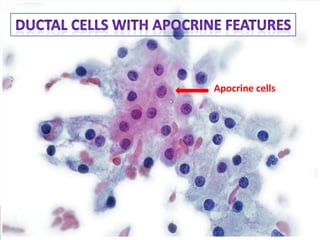Apocrine cells

Copyright © Wondershare Software

 