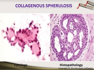 Cytology

Histopathology
Copyright © Wondershare Software

 