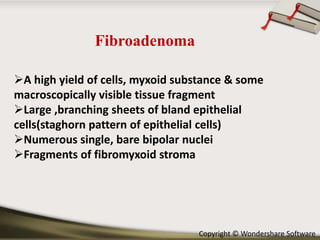 Fibroadenoma
A high yield of cells, myxoid substance & some
macroscopically visible tissue fragment
Large ,branching sheets of bland epithelial
cells(staghorn pattern of epithelial cells)
Numerous single, bare bipolar nuclei
Fragments of fibromyxoid stroma

Copyright © Wondershare Software

 