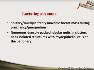 • Solitary/multiple freely movable breast mass during
pregnancy/puerperium
• Numerous densely packed lobular units in clusters
or as isolated structures with myoepithelial cells at
the periphery

Copyright © Wondershare Software

 