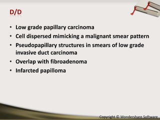 • Low grade papillary carcinoma
• Cell dispersed mimicking a malignant smear pattern
• Pseudopapillary structures in smears of low grade
invasive duct carcinoma
• Overlap with fibroadenoma
• Infarcted papilloma

Copyright © Wondershare Software

 