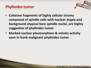 • Cohesive fragments of highly cellular stroma
composed of spindle cells with nuclear atypia and
background atypical bare spindle nuclei, are highly
suggestive of phylloides tumor
• Marked nuclear pleomorphism & mitotic activity
seen in frank malignant phylloides tumor .

Copyright © Wondershare Software

 