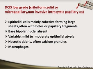  Epithelial cells mainly cohesive forming large
sheets,often with holes or papillary fragments
 Bare bipolar nuclei absent
 Variable ,mild to moderate epithelial atypia
 Necrotic debris, often calcium granules
 Macrophages

Copyright © Wondershare Software

 