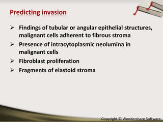  Findings of tubular or angular epithelial structures,
malignant cells adherent to fibrous stroma
 Presence of intracytoplasmic neolumina in
malignant cells
 Fibroblast proliferation
 Fragments of elastoid stroma

Copyright © Wondershare Software

 
