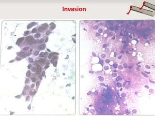 Invasion

Copyright © Wondershare Software

 