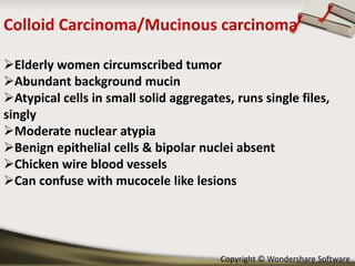 Colloid Carcinoma/Mucinous carcinoma
Elderly women circumscribed tumor
Abundant background mucin
Atypical cells in small solid aggregates, runs single files,
singly
Moderate nuclear atypia
Benign epithelial cells & bipolar nuclei absent
Chicken wire blood vessels
Can confuse with mucocele like lesions

Copyright © Wondershare Software

 