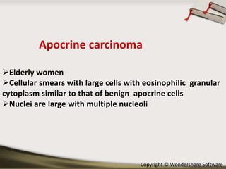 Apocrine carcinoma
Elderly women
Cellular smears with large cells with eosinophilic granular
cytoplasm similar to that of benign apocrine cells
Nuclei are large with multiple nucleoli

Copyright © Wondershare Software

 