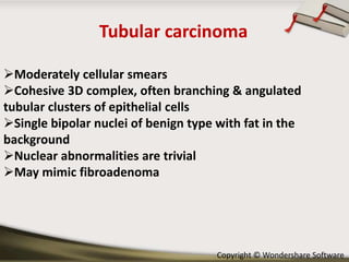 Tubular carcinoma
Moderately cellular smears
Cohesive 3D complex, often branching & angulated
tubular clusters of epithelial cells
Single bipolar nuclei of benign type with fat in the
background
Nuclear abnormalities are trivial
May mimic fibroadenoma

Copyright © Wondershare Software

 