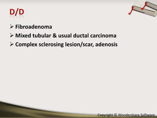  Fibroadenoma
 Mixed tubular & usual ductal carcinoma
 Complex sclerosing lesion/scar, adenosis

Copyright © Wondershare Software

 