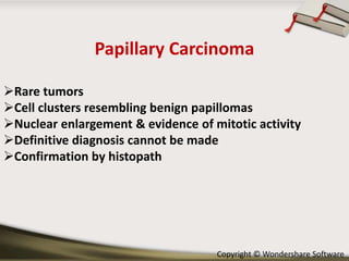 Papillary Carcinoma
Rare tumors
Cell clusters resembling benign papillomas
Nuclear enlargement & evidence of mitotic activity
Definitive diagnosis cannot be made
Confirmation by histopath

Copyright © Wondershare Software

 