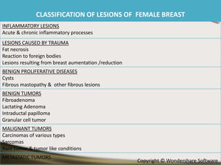CLASSIFICATION OF LESIONS OF FEMALE BREAST
INFLAMMATORY LESIONS
Acute & chronic inflammatory processes
LESIONS CAUSED BY TRAUMA
Fat necrosis
Reaction to foreign bodies
Lesions resulting from breast aumentation /reduction
BENIGN PROLIFERATIVE DISEASES
Cysts
Fibrous mastopathy & other fibrous lesions
BENIGN TUMORS
Fibroadenoma
Lactating Adenoma
Intraductal papilloma
Granular cell tumor
MALIGNANT TUMORS
Carcinomas of various types
Sarcomas
Rare tumor & tumor like conditions

METASTATIC TUMORS

Copyright © Wondershare Software

 