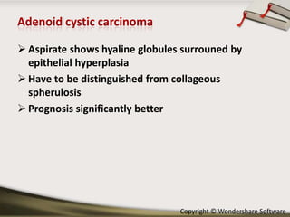  Aspirate shows hyaline globules surrouned by
epithelial hyperplasia
 Have to be distinguished from collageous
spherulosis
 Prognosis significantly better

Copyright © Wondershare Software

 