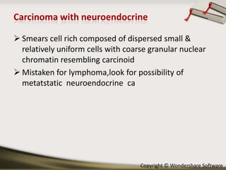  Smears cell rich composed of dispersed small &
relatively uniform cells with coarse granular nuclear
chromatin resembling carcinoid
 Mistaken for lymphoma,look for possibility of
metatstatic neuroendocrine ca

Copyright © Wondershare Software

 