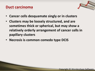 • Cancer cells desquamate singly or in clusters
• Clusters may be loosely structured, and are
sometimes thick or spherical, but may show a
relatively orderly arrangement of cancer cells in
papillary clusters
• Necrosis is common comedo type DCIS

Copyright © Wondershare Software

 