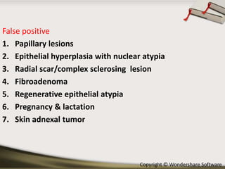 False positive
1. Papillary lesions
2. Epithelial hyperplasia with nuclear atypia
3. Radial scar/complex sclerosing lesion
4. Fibroadenoma
5. Regenerative epithelial atypia
6. Pregnancy & lactation
7. Skin adnexal tumor

Copyright © Wondershare Software

 