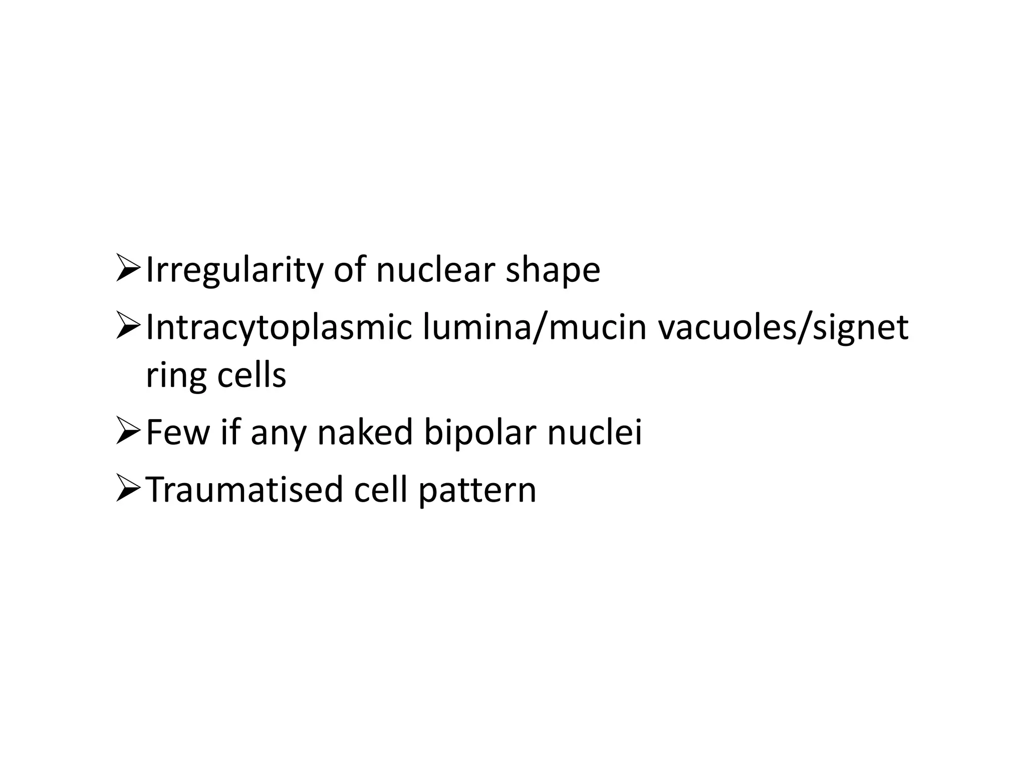 Irregularity of nuclear shape
Intracytoplasmic lumina/mucin vacuoles/signet
ring cells
Few if any naked bipolar nuclei
Traumatised cell pattern

 