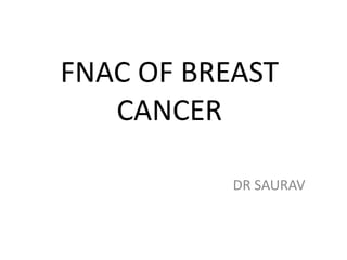 FNAC OF BREAST
CANCER
DR SAURAV

 