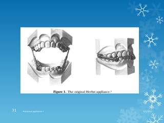 9/2/2013Functional appliances- I31
 