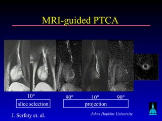 Johns Hopkins University
MRI-guided PTCAMRI-guided PTCA
90° 10° 90°10°
slice selection projection
J. Serfaty et. al.
 