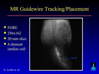 Johns Hopkins University
MR Guidewire Tracking/PlacementMR Guidewire Tracking/Placement
sheath
 FGREFGRE
 256x162256x162
 20 mm slice20 mm slice
 4 element4 element
cardiac coilcardiac coil
A. Lardo et. al.
 