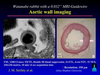 Johns Hopkins University
mm
B
FSE, 1200/13-msec TR/TE, Double IR blood suppression, 16 ETL, 4-cm FOV, 32 NEX,
256x256 matrix, 10 min 14 sec acquisition time
ACM
• Resolution: 150 µm
J. M. Serfaty et al.
Watanabe rabbit with a 0.032” MRI-Guidewire
Aortic wall imaging
 