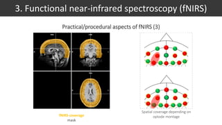 Spatial coverage depending on
optode montagefNIRS-coverage
mask
3. Functional near-infrared spectroscopy (fNIRS)
Practical/procedural aspects of fNIRS (3)
 