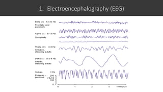 1. Electroencephalography (EEG)
 