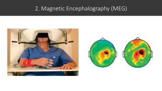 2. Magnetic Encephalography (MEG)
 
