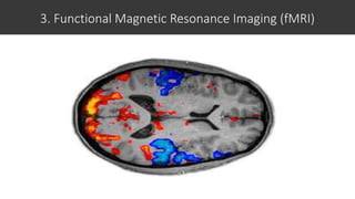 3. Functional Magnetic Resonance Imaging (fMRI)
 