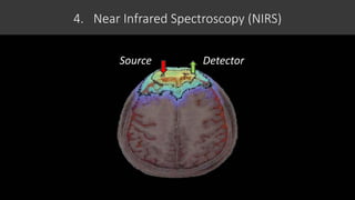 4. Near Infrared Spectroscopy (NIRS)
Source Detector
 
