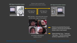 NIRS Signal for
Yes and No
EEG Signal for
Yes and No
NIRS Signal Acquisition System EEG Signal Acquisition System
ALS patient attending to
auditory stimuli
NIRS optodes + EEG electrodes placed
on the motor region of the patient
Patients are presented 20 personal
questions, 10 true and 10 true false in
random order in each session
Patient thinking “ja,ja,…” (yes) and
“Nein,Nein,…” (no) for true and false
sentence, respectively for 15 sec.
*Patient’s face revealed with
permission from primary caretaker
Chaudhary et al., PLoS Biology 2017.Chaudhary et al., Nature Reviews Neurology 2016
 
