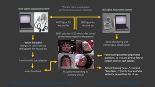 NIRS Signal for
Yes and No
EEG Signal for
Yes and No
NIRS Signal Acquisition System EEG Signal Acquisition System
Audio Feedback ALS patient attending to
auditory stimuli
NIRS optodes + EEG electrodes placed
on the motor region of the patient
Feature Extraction
Changes in oxy or de-oxy
hemoglobin for Yes and No
Train the NIRS SVM classifer
Patients are presented 20 personal
questions, 10 true and 10 true false in
random order in each session
Patient thinking “ja,ja,…” (yes) and
“Nein,Nein,…” (no) for true and false
sentence, respectively for 15 sec.
Sleep Monitoring and
offline signal classification
*Patient’s face revealed with
permission from primary caretaker
Chaudhary et al., PLoS Biology 2017.Chaudhary et al., Nature Reviews Neurology 2016
 