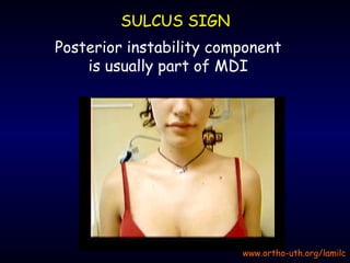 Posterior instability | PPT