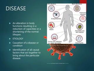 DISEASE
 An alteration in body
functions resulting in a
reduction of capacities or a
shortening of the normal
lifespan.
 ETIOLOGY
 Causation of a disease or
condition
 Identification of all causal
factors that act together to
bring about the particular
disease.
This Photo by Unknown Author is licensed under CC BY-NC
This Photo by Unknown Author is licensed under CC BY
 