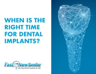 WHEN IS THE
RIGHT TIME
FOR DENTAL
IMPLANTS?
 