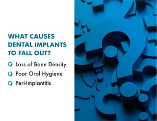 WHAT CAUSES
DENTAL IMPLANTS
TO FALL OUT?
Loss of Bone Density
Poor Oral Hygiene
Peri-Implantitis
 
