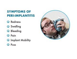 SYMPTOMS OF
PERI-IMPLANTITIS
Redness
Swelling
Bleeding
Pain
Implant Mobility
Puss
 