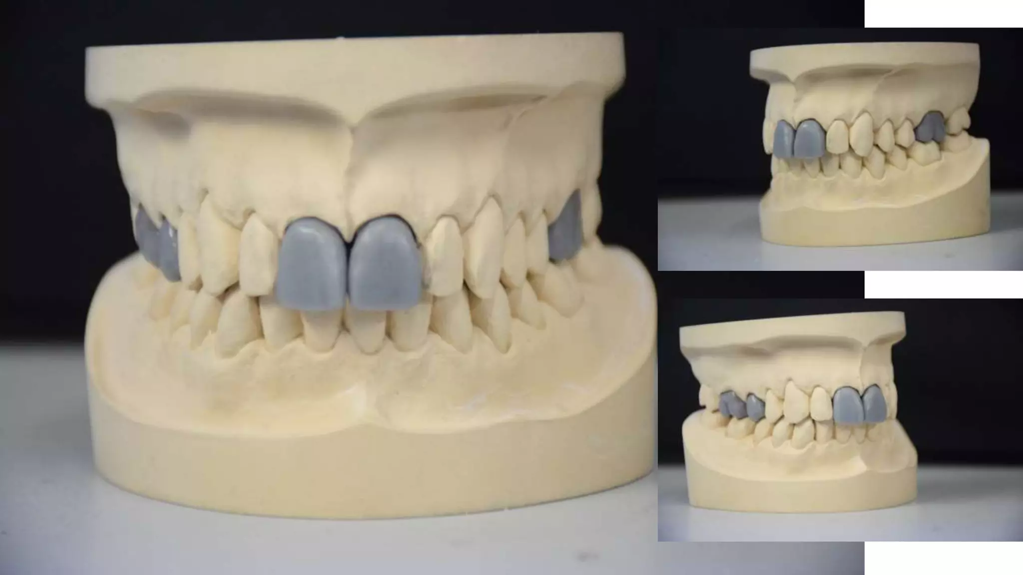Monolithic Lithium Disilicate, the laboratory procedures. | PPTX