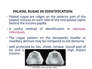 Radial Rugae Pattern FORENSIC ODONTOLOGY CLASS FOR 3rd BDS .pptx