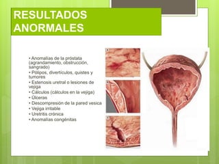 RESULTADOS
ANORMALES
• Anomalías de la próstata
(agrandamiento, obstrucción,
sangrado)
• Pólipos, divertículos, quistes y
...