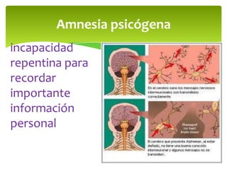Amnesia psicógena
incapacidad
repentina para
recordar
importante
información
personal
 
