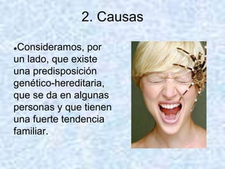 2. Causas
●Consideramos, por
un lado, que existe
una predisposición
genético-hereditaria,
que se da en algunas
personas y que tienen
una fuerte tendencia
familiar.
 