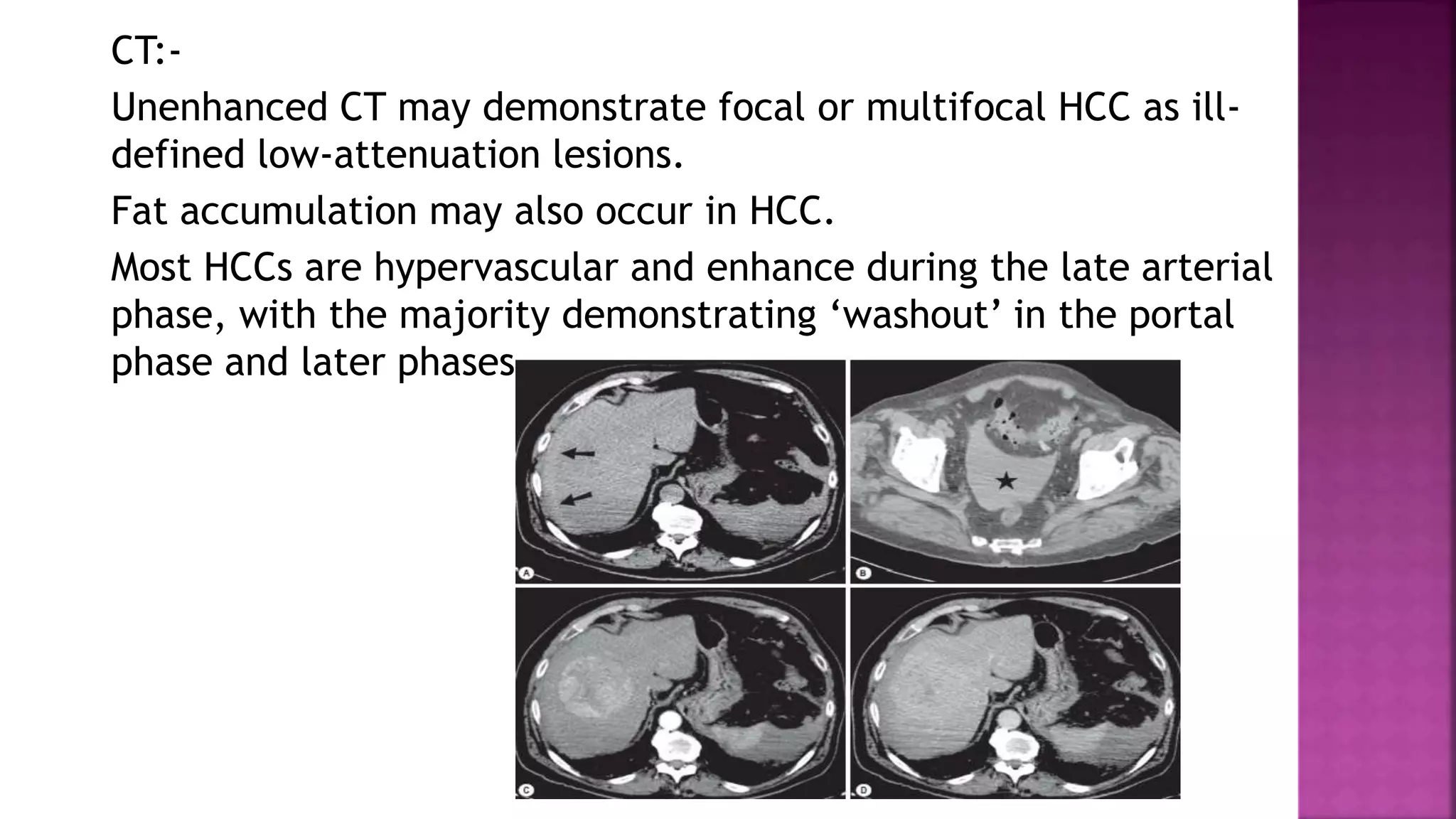 CT:-
Unenhanced CT may demonstrate focal or multifocal HCC as ill-
defined low-attenuation lesions.
Fat accumulation may also occur in HCC.
Most HCCs are hypervascular and enhance during the late arterial
phase, with the majority demonstrating ‘washout’ in the portal
phase and later phases.
 
