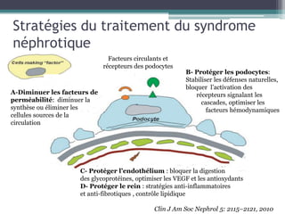 Stratégies du traitement du syndrome
néphrotique
                               Facteurs circulants et
                             récepteurs des podocytes
                                                         B- Protéger les podocytes:
                                                         Stabiliser les défenses naturelles,
                                                         bloquer l’activation des
A-Diminuer les facteurs de                                   récepteurs signalant les
perméabilité: diminuer la                                      cascades, optimiser les
synthèse ou éliminer les                                         facteurs hémodynamiques
cellules sources de la
circulation




                    C- Protéger l’endothélium : bloquer la digestion
                    des glycoprotéines, optimiser les VEGF et les antioxydants
                    D- Protéger le rein : stratégies anti-inflammatoires
                    et anti-fibrotiques , contrôle lipidique

                                              Clin J Am Soc Nephrol 5: 2115–2121, 2010
 