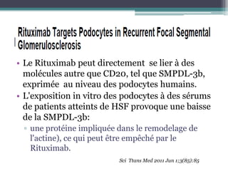 Le Rituximab……
• Le Rituximab peut directement se lier à des
  molécules autre que CD20, tel que SMPDL-3b,
  exprimée au niveau des podocytes humains.
• L'exposition in vitro des podocytes à des sérums
  de patients atteints de HSF provoque une baisse
  de la SMPDL-3b:
 ▫ une protéine impliquée dans le remodelage de
   l'actine), ce qui peut être empêché par le
   Rituximab.
                          Sci Ttans Med 2011 Jun 1;3(85):85
 